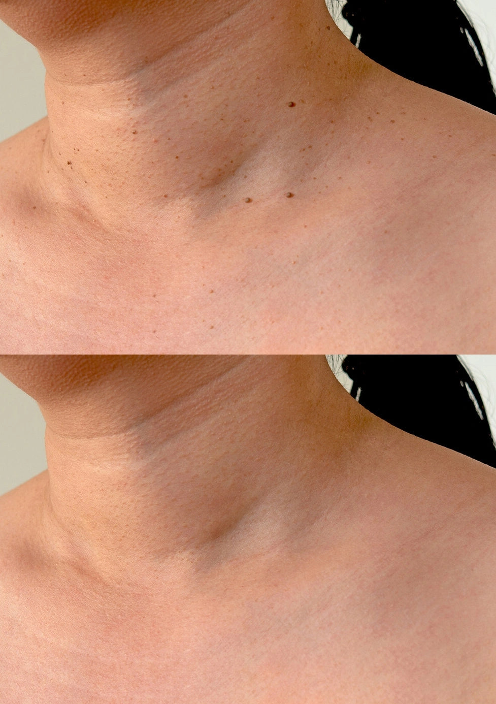 ClearBen™ Et Beni Temizleme Kiti